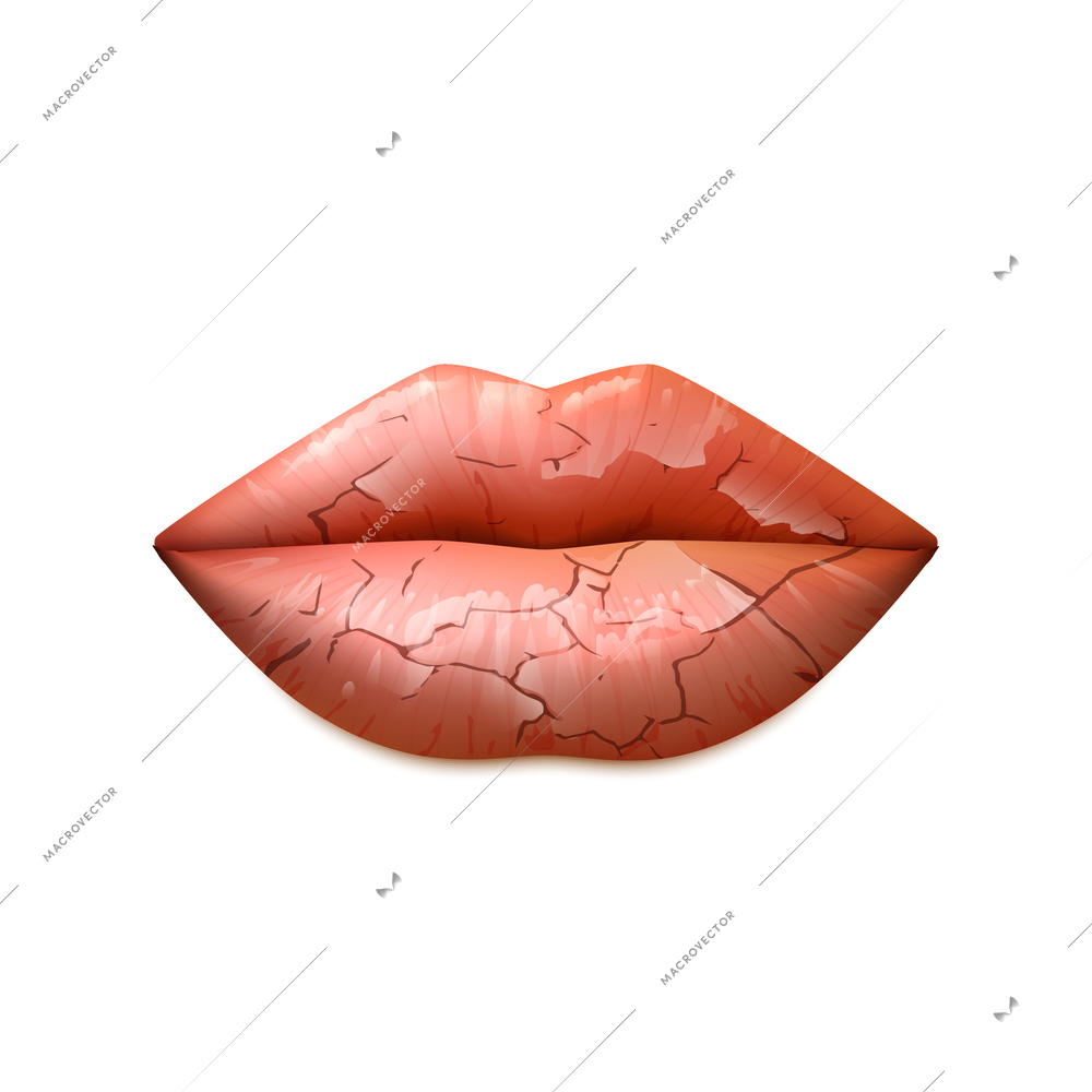 Dry cracked woman lips in a classic shape realistic isolated vector illustration