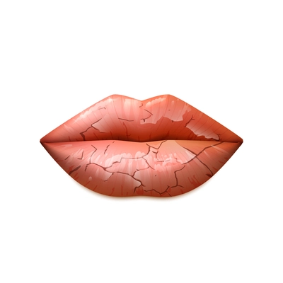 Dry cracked woman lips in a classic shape realistic isolated vector illustration
