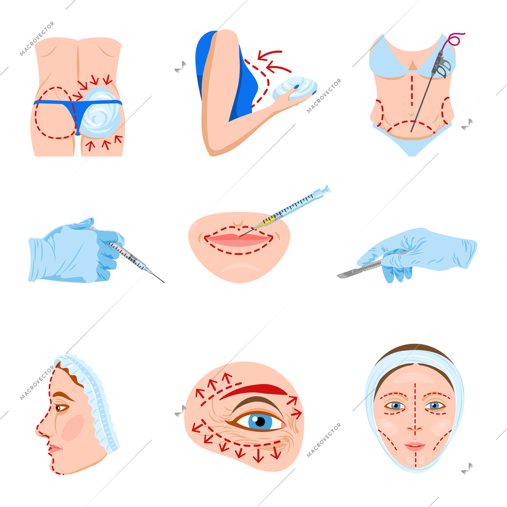 Cosmetic facial and body lift plastic surgery flat icon collection with lips contouring abstract isolated vector illustration