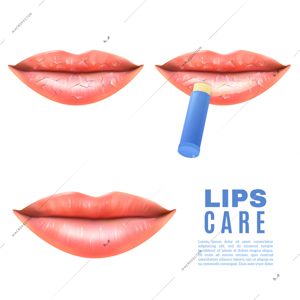 Lip care balsam for moisturizing treatment of chapped dry and sensitive lips white background poster realistic vector illustration