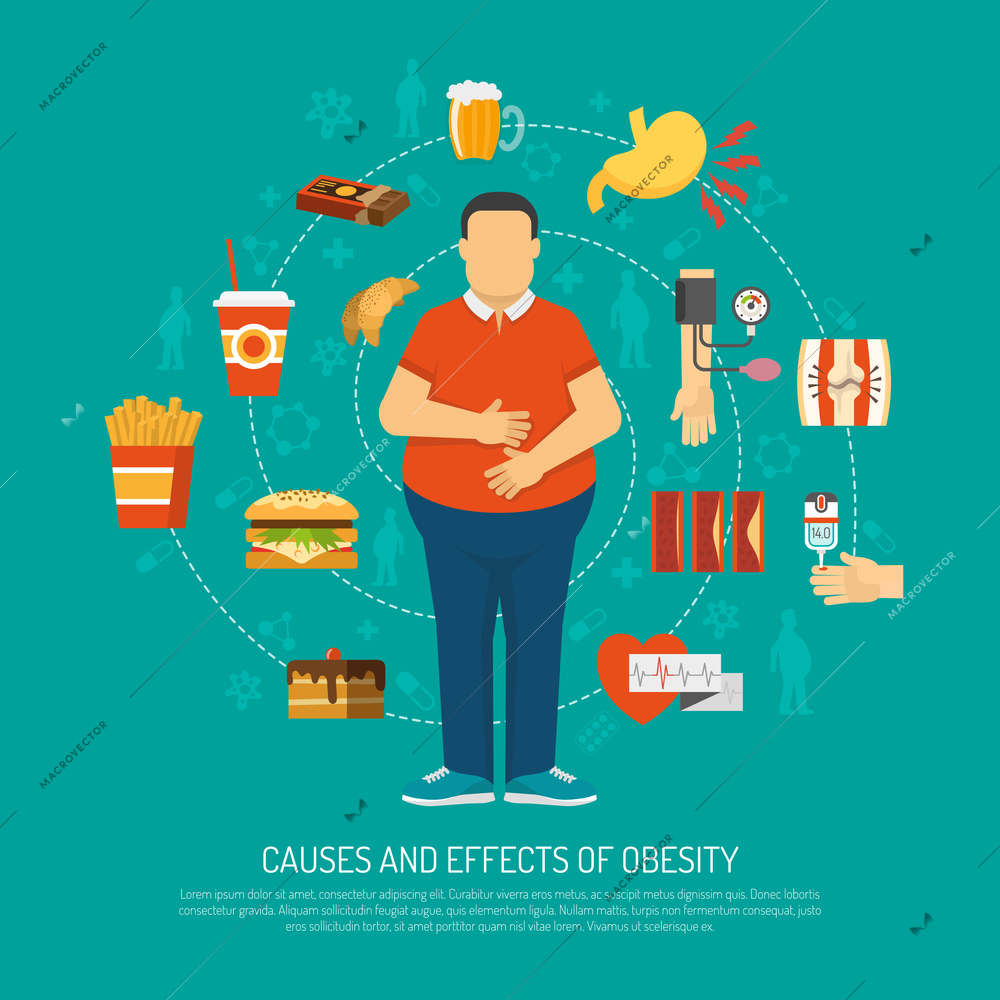 Color illustration causes and effects of obesity vector illustration