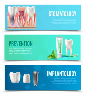 Medical oral healthcare 3 horizontal banners set with prevention stomatology and dental implants bookmarks isolated vector illustration