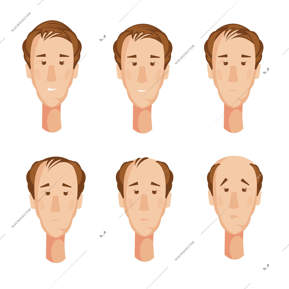 Storyboard with six isolated cartoon male character heads suffering from hair loss with unhappy facial expressions vector illustration