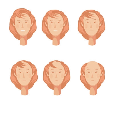 Hair loss storyboard composition of six isolated full faces of balding woman character at various points vector illustration