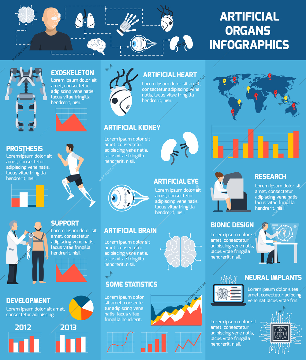 Bionic artificial organs infographics with different body parts which can be implanted in flat style vector illustration