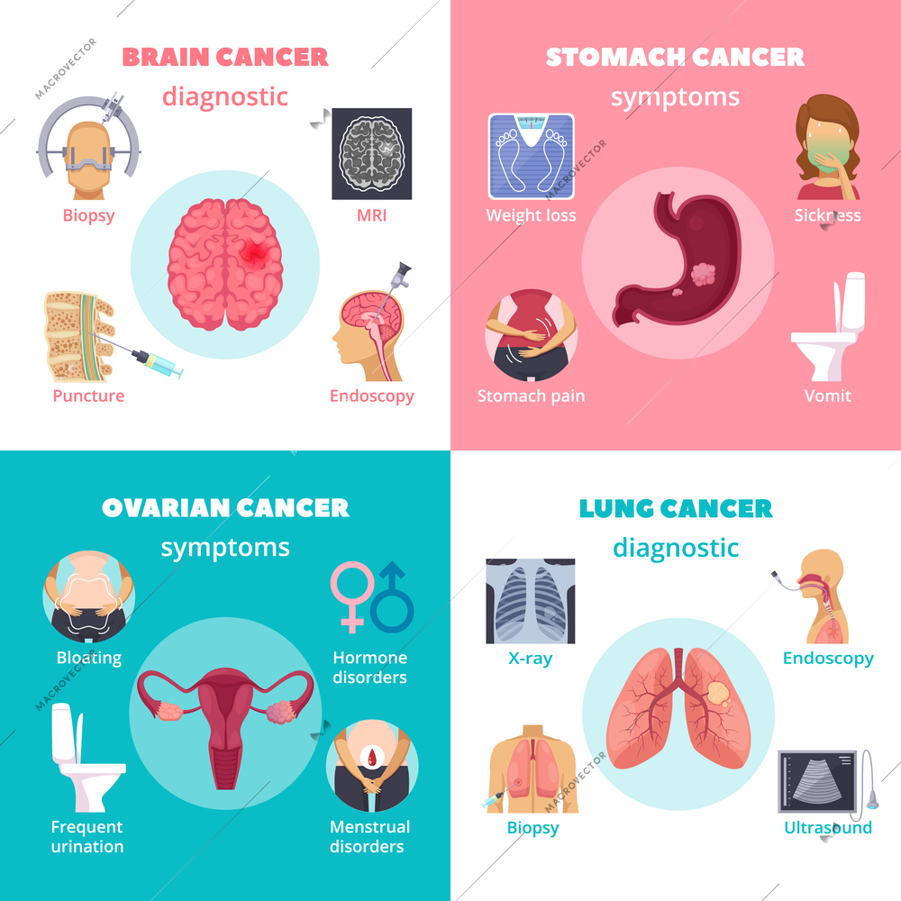 Oncology 2x2 design concept with information about symptoms and diagnostics of brain stomach ovarian and lung types of cancer flat vector illustration