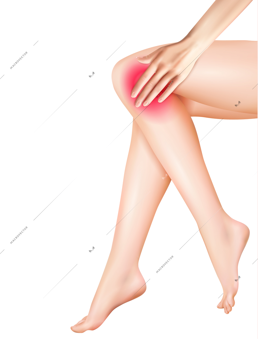 Female legs and pain with knee pain symbols vector realistic illustration