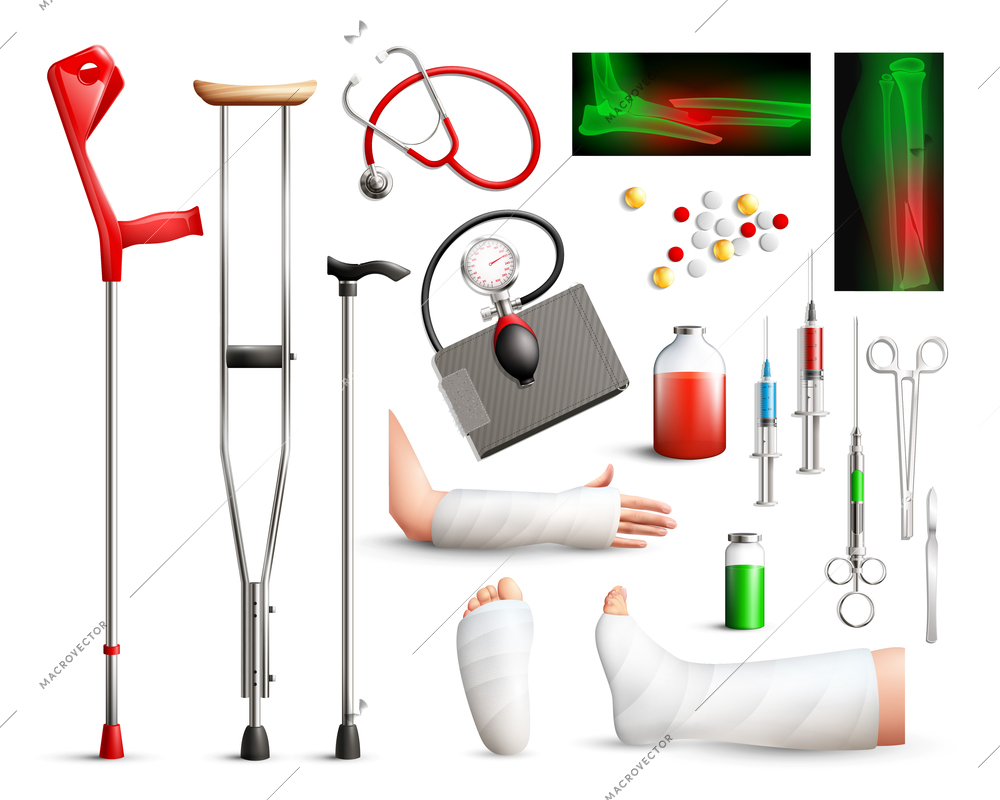 Trauma surgery realistic set with radiograph plastered limbs stick crutches surgical tools  on white background isolated vector illustration