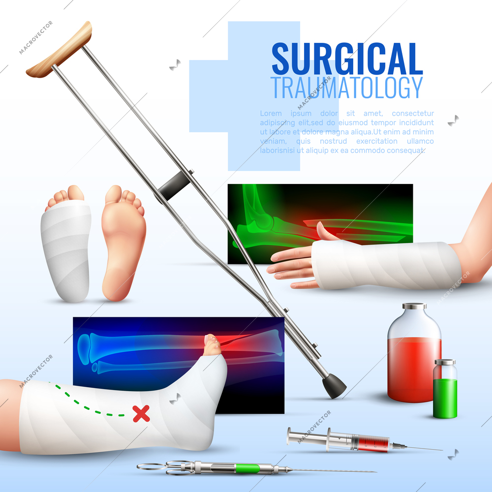 Surgical traumatology realistic concept with hand foot and leg injury symbols vector illustration