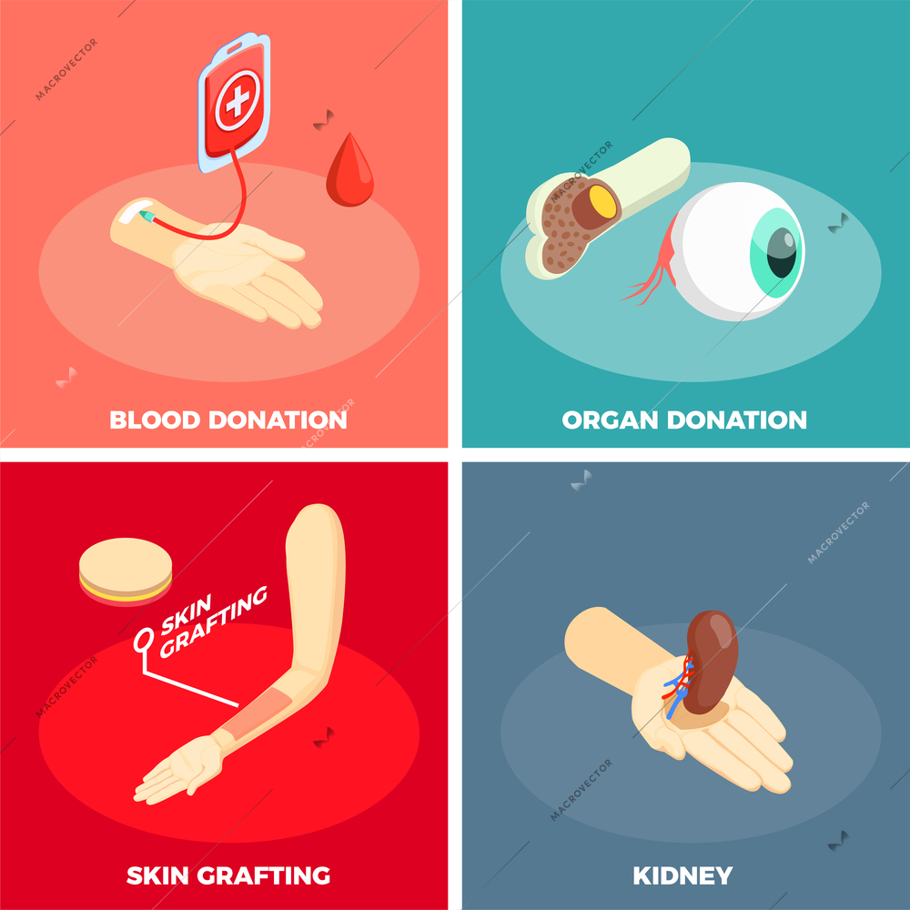 Transplantation 2x2 design concept with organ donation skin grafting and blood donation square icons isometric vector illustration