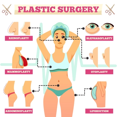 Plastic surgery orthogonal flowchart with woman and types of operations for face and body flat vector illustration