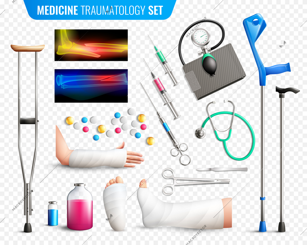 Set of medical tools, x-ray with bones fracture, traumas of limbs, transparent background isolated vector illustration