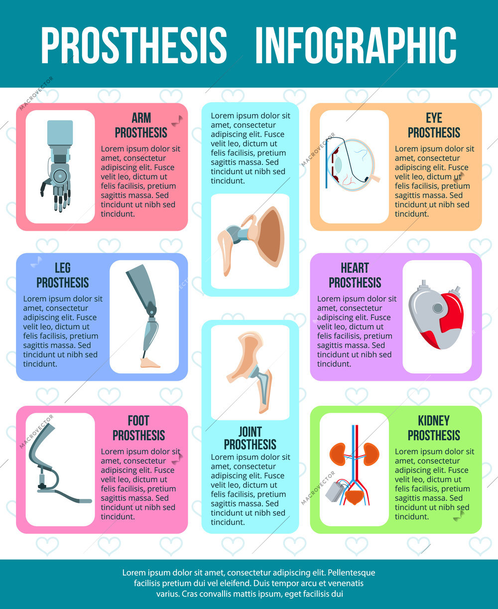 Artificial body parts organs mechanical heart valve kidney implants infographic poster with prothesis flat images vector illustration