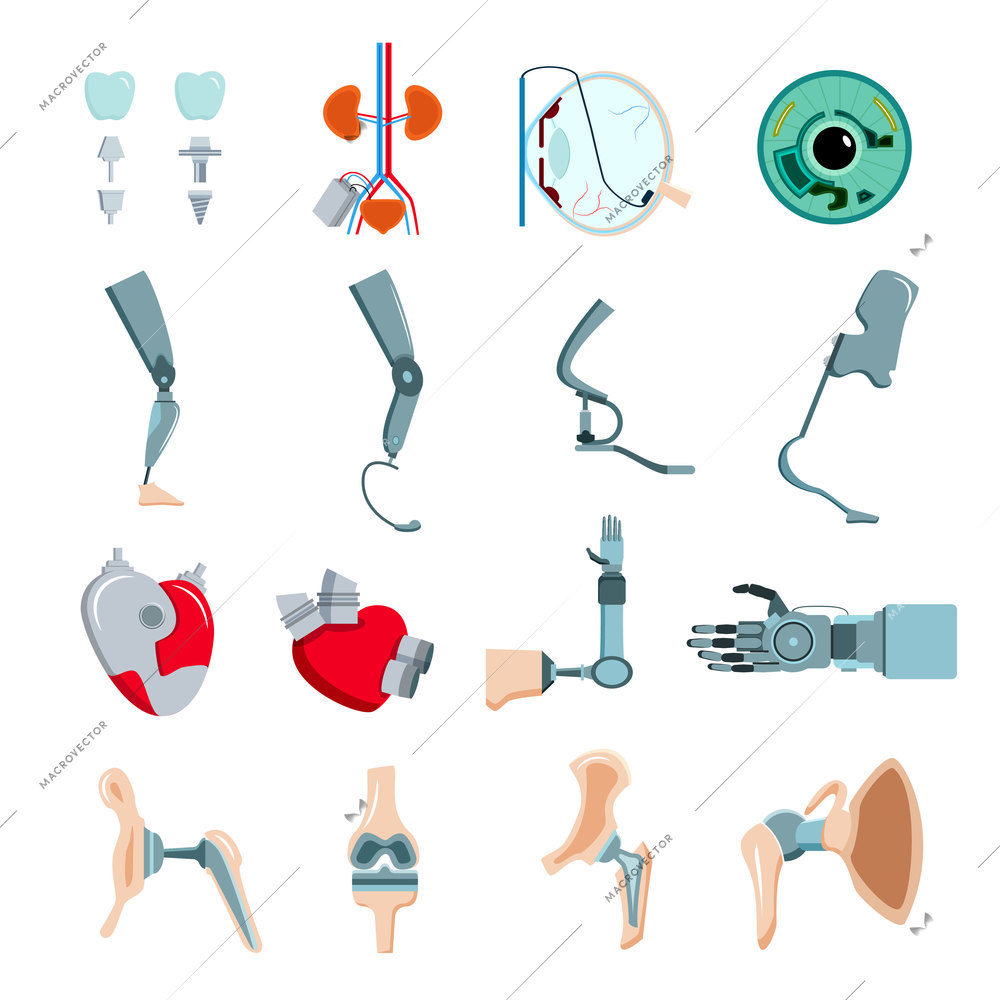 Orthopedic prothesis medical implants artificial body parts flat icons collection with mechanical heart valve isolated vector illustration