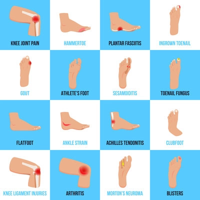 Set of flat icons with foot problems on white blue background isolated vector illustration