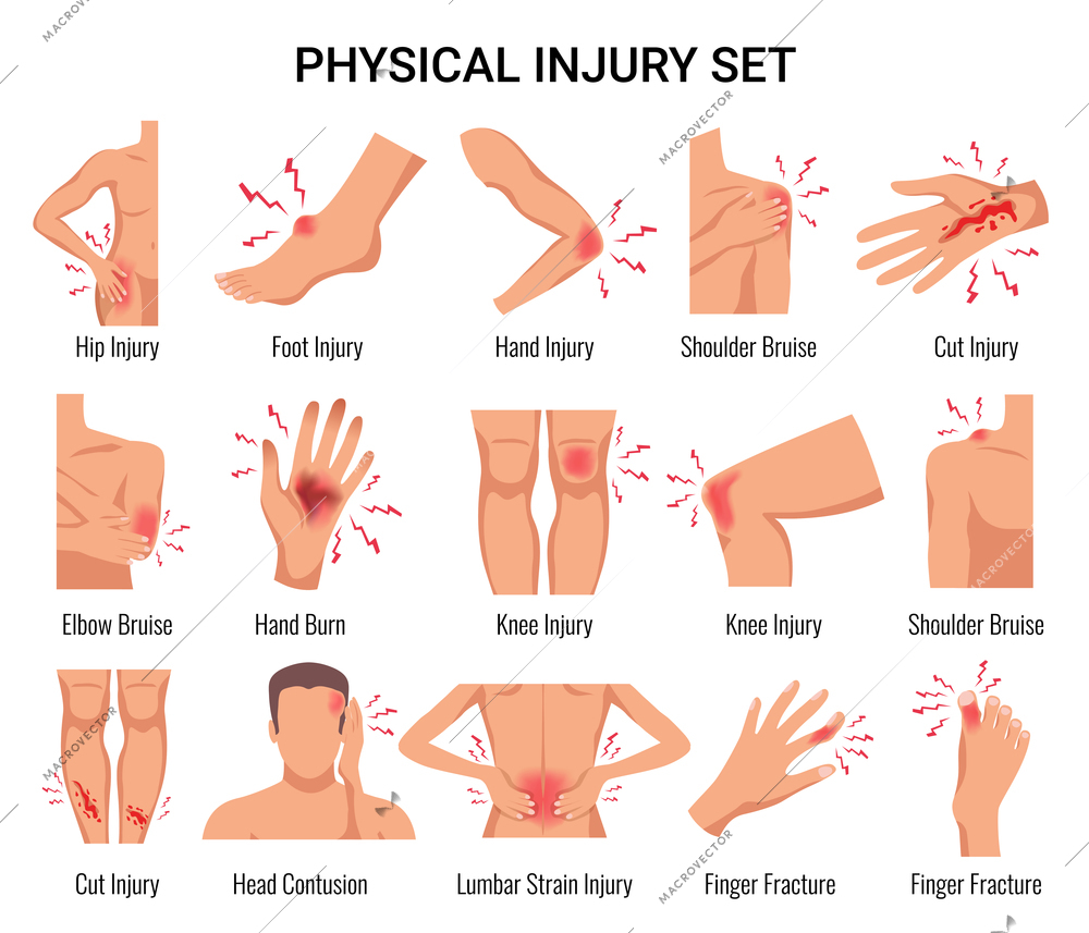 Human body parts physical injury flat set with head contusion elbow bruise open cut wounds vector illustration