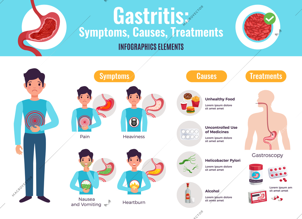 Gastritis symptoms causes treatments comprehensive infographic poster with unhealthy food examples gastroscopy procedure medicine flat vector illustration