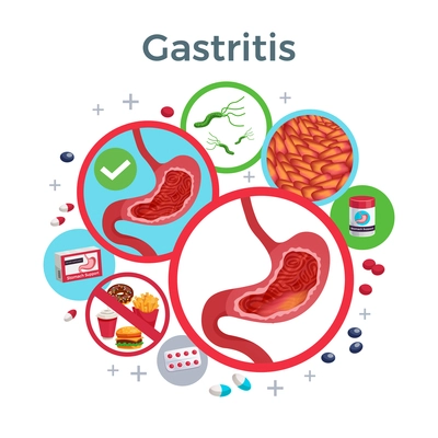 Gastritis disease symptoms causes medicine flat circular composition of healthy and affected stomach bacteria food vector illustration