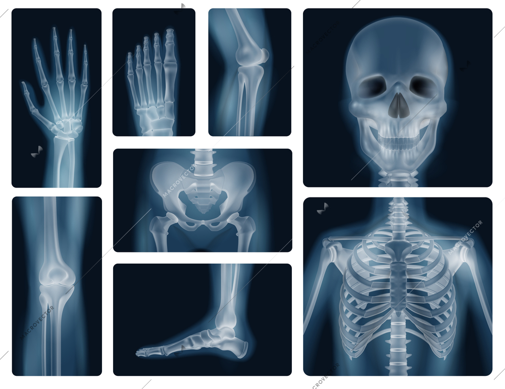 Realistic x-ray shots of human bones of skull pelvis thorax knee and limbs isolated vector illustration