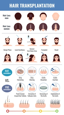 Baldness of men and women methods of hair transplantation set with infographic elements isolated vector illustration