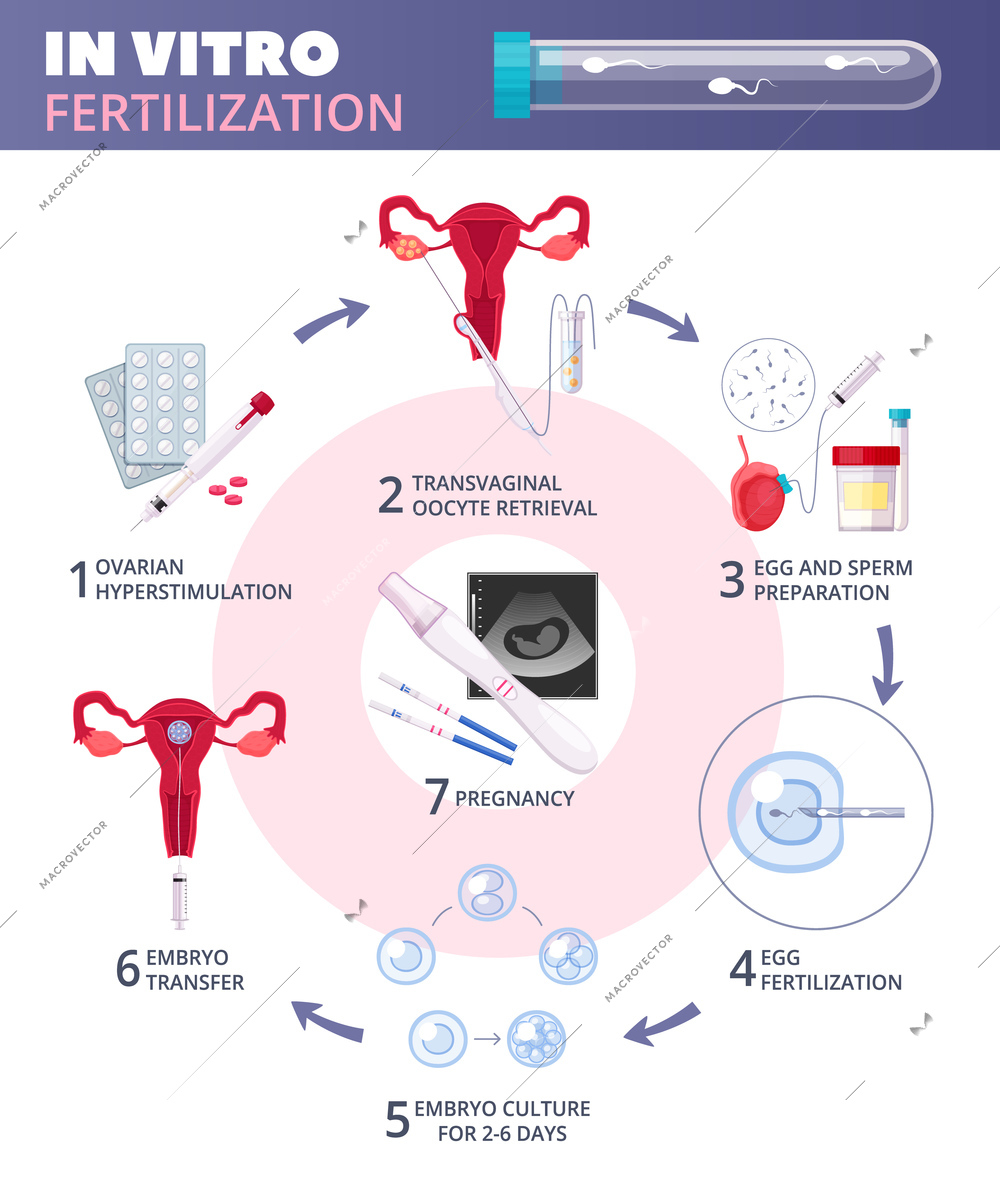 Colored flat in vitro fertilization IVF  infographics with steps from ovarian huperstimulation to pregnancy vector illustration