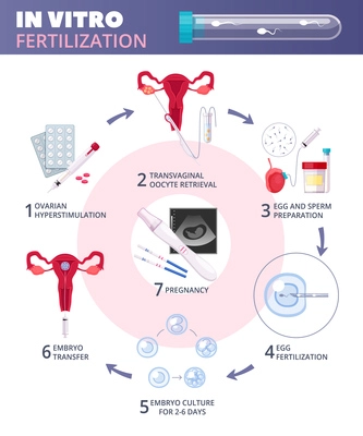 Colored flat in vitro fertilization IVF  infographics with steps from ovarian huperstimulation to pregnancy vector illustration