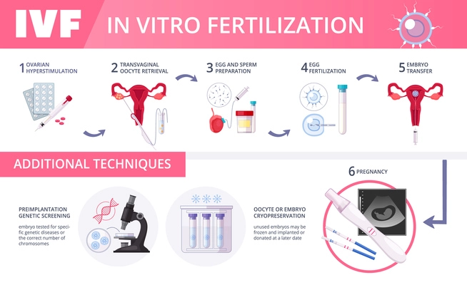 Colored in vitro fertilization IVF flat infographics with steps of additional techniques vector illustration