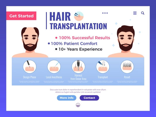 Hair transplantation web banner with infographics advertising and interface elements on white background vector illustration