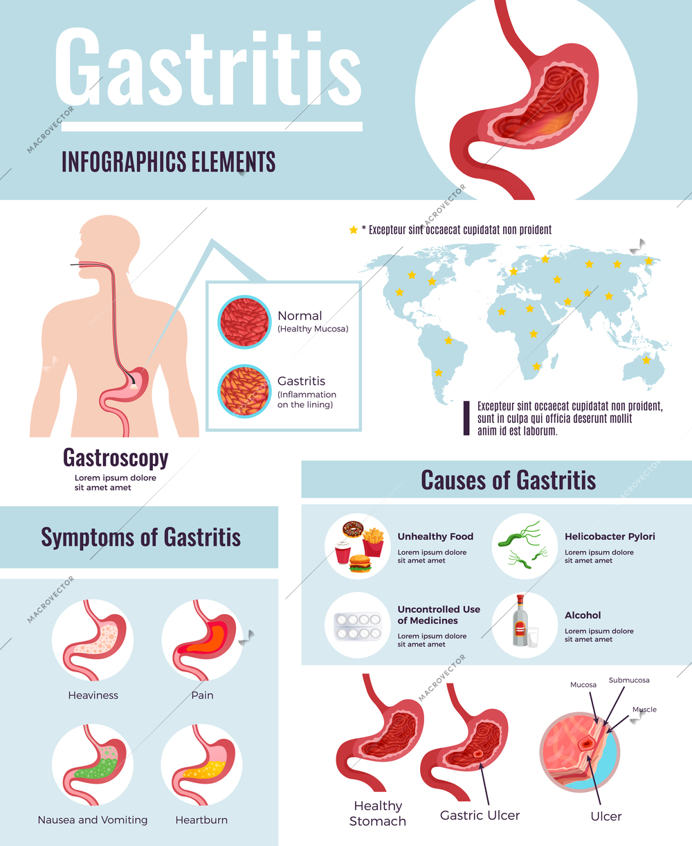 Gastritis symptoms stomach ulcer causes information on unhealthy food habits world population affected infographic poster vector illustration