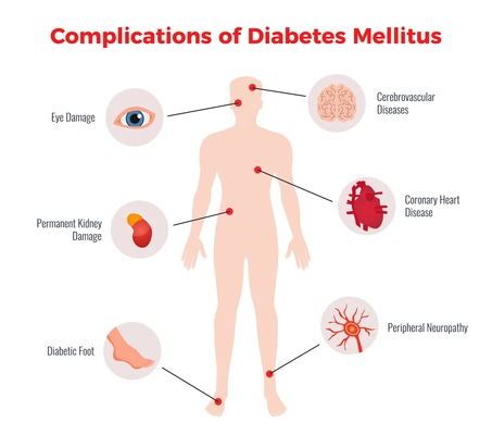 Diabetes complications medical educational chart poster with affected human organs damages depiction and description flat vector illustration