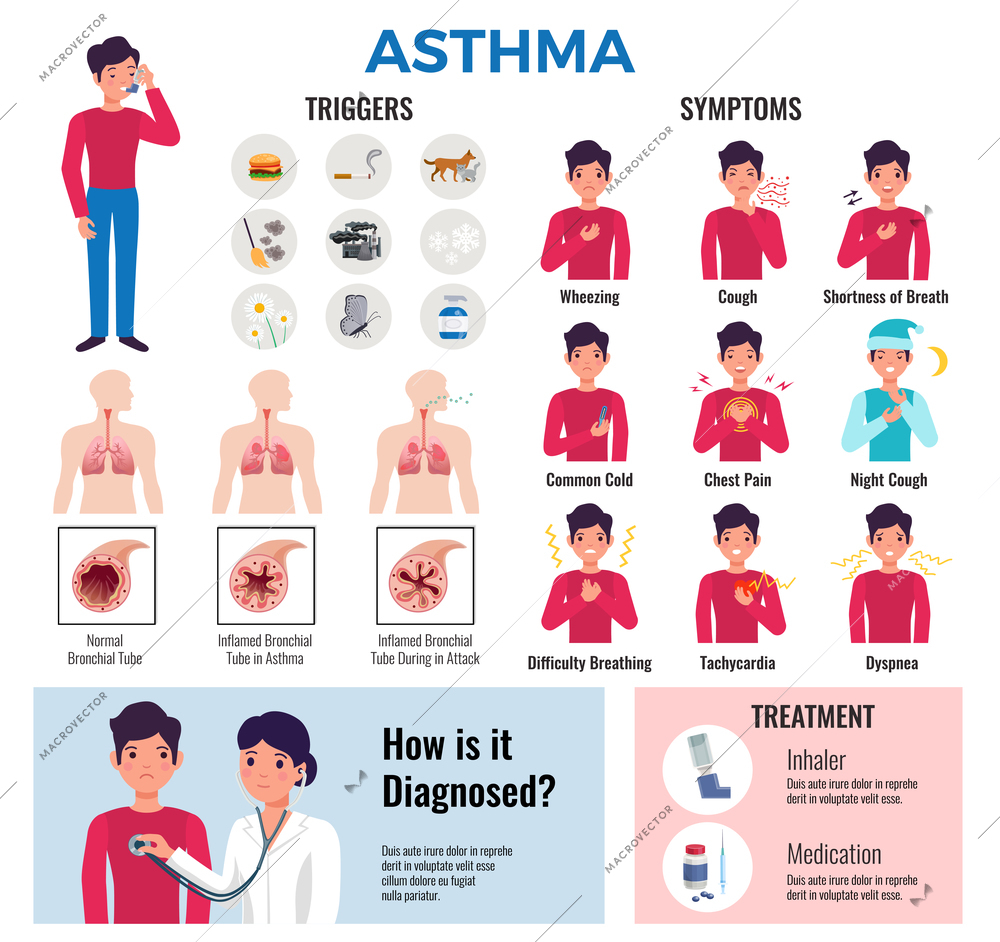 Asthma chronic disease flat infographic elements collection with triggers symptoms causes diagnosis medication and treatment vector illustration