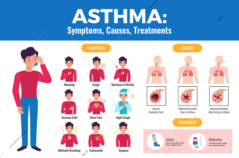 Asthma symptoms causes treatment flat medical poster with patient holding inhaler and inflamed bronchial tube vector illustration