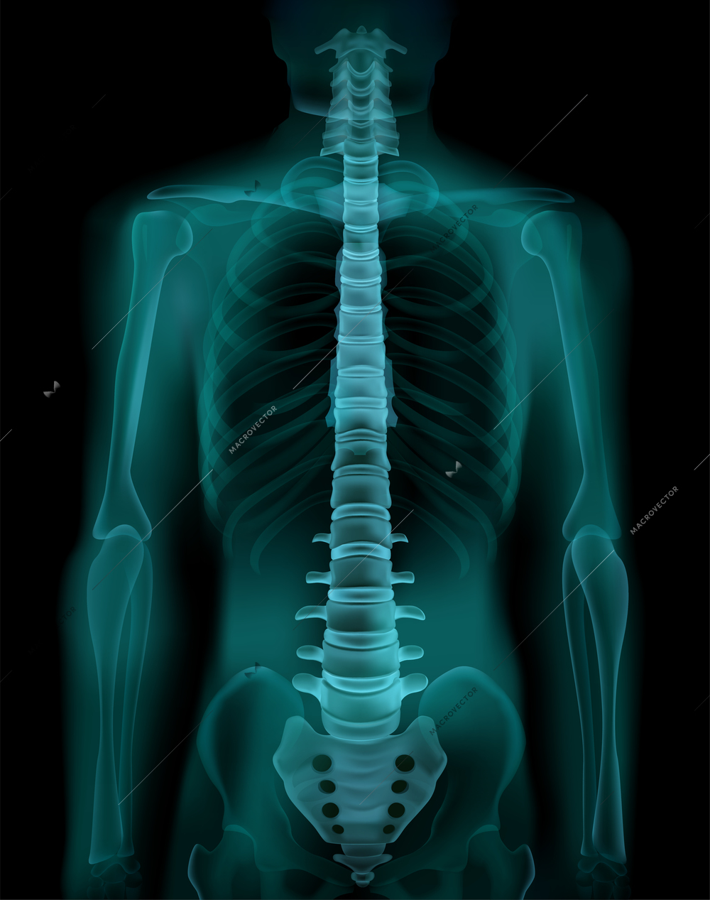 Human spine and pelvis realistic x-ray ct radiography fluoroscopy medical screening  exam image vector illustration