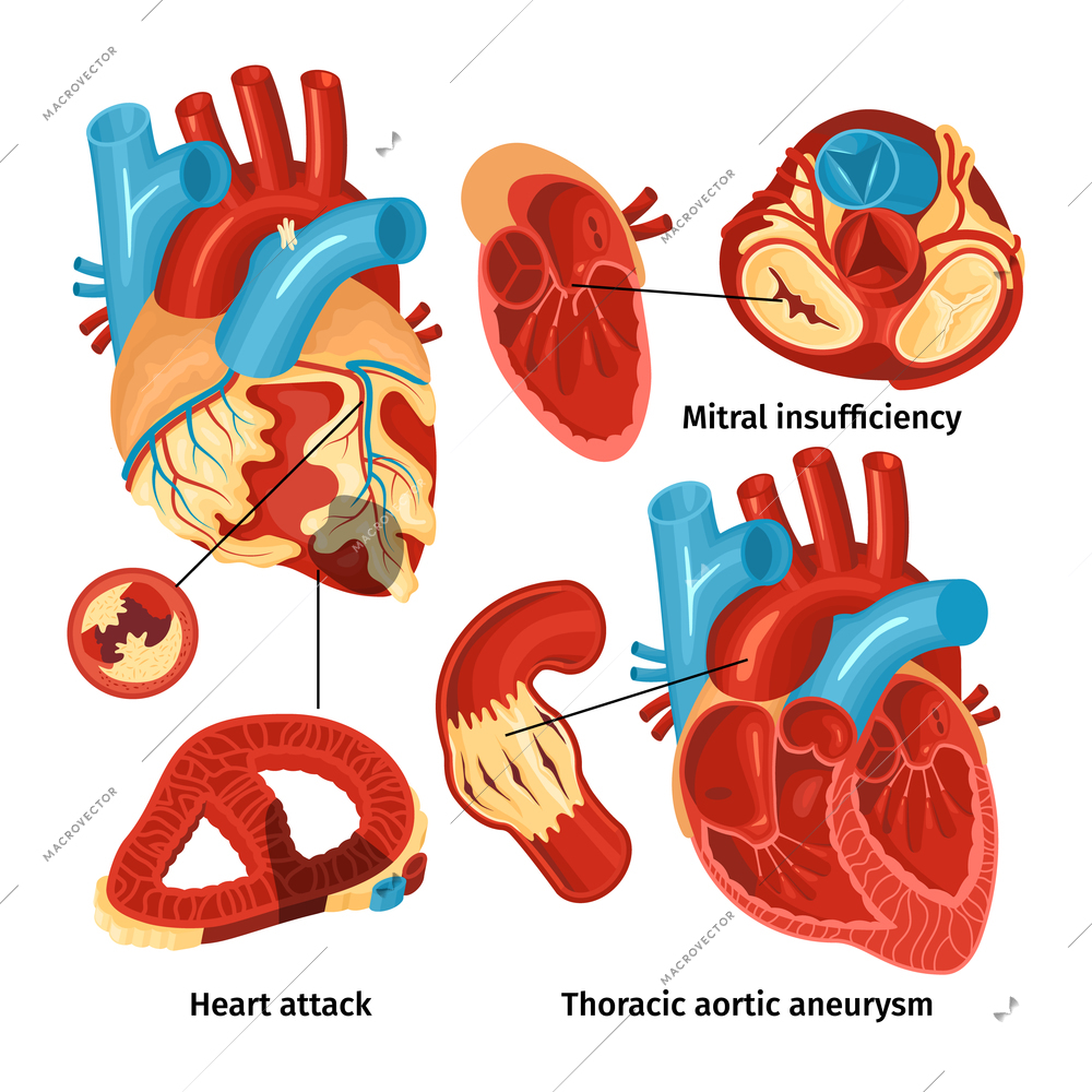 Flat icons set with heart anatomy and different types of diseases isolated on white background vector illustration