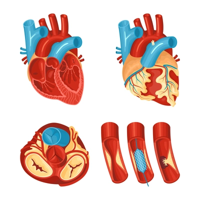 Anatomy of healthy and diseased heart flat set isolated on white background vector illustration