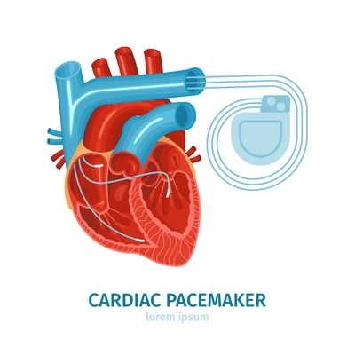 Flat composition with heart and cardiac pacemaker on white background vector illustration