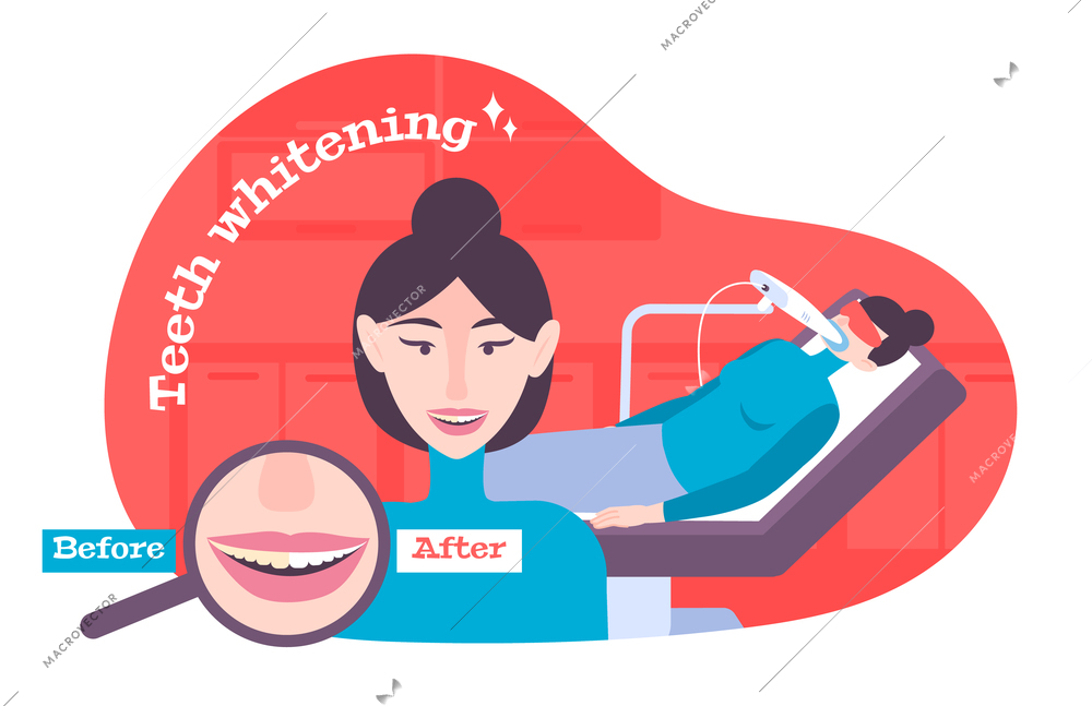 Teeth whitening flat composition with view of dental procedure before and after images with human characters vector illustration