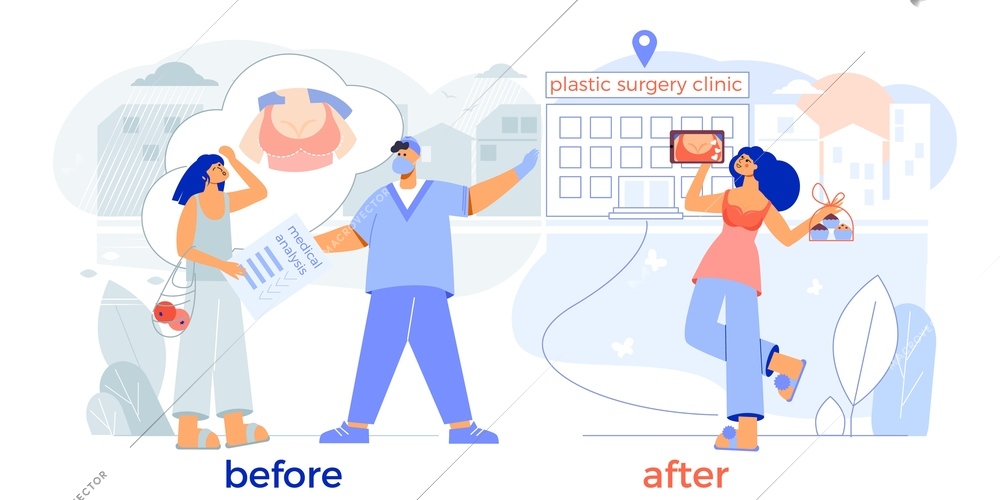 Plastic surgery breast enlargement before after flat composition with happy patient surgeon clinic entrance vector illustration