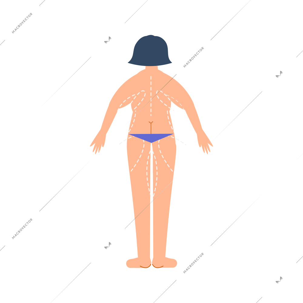 Plastic surgery flat composition with body contouring and rejuvenation for female patient vector illustration