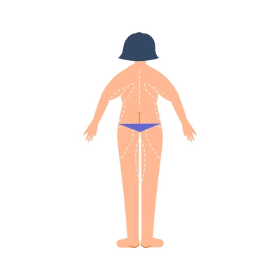 Plastic surgery flat composition with body contouring and rejuvenation for female patient vector illustration