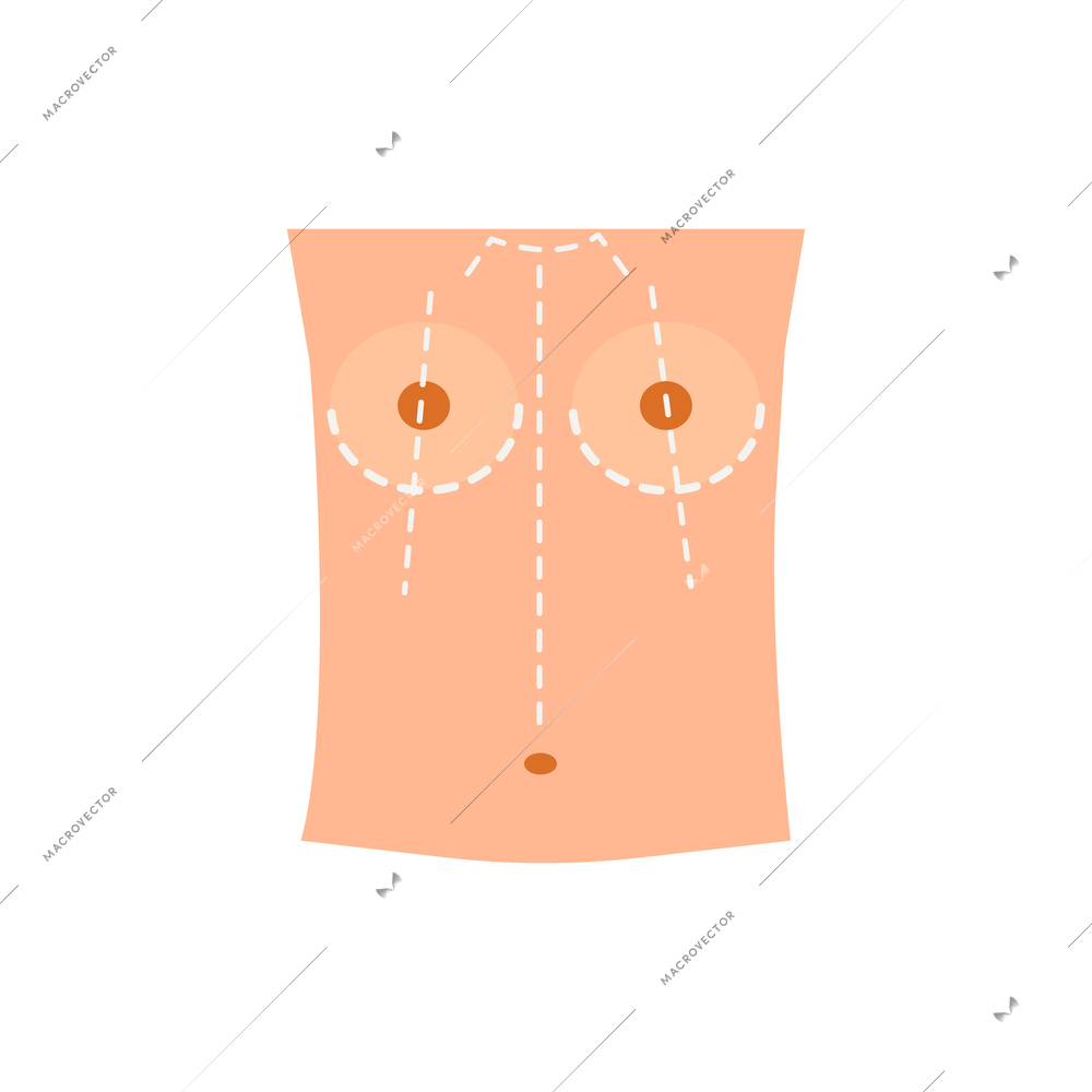 Plastic surgery flat composition with body contouring and rejuvenation for female patient vector illustration