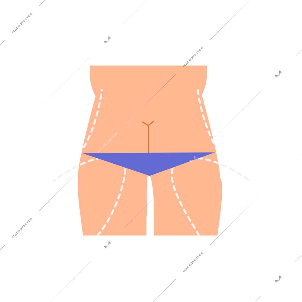 Plastic surgery flat composition with body contouring and rejuvenation for female patient vector illustration