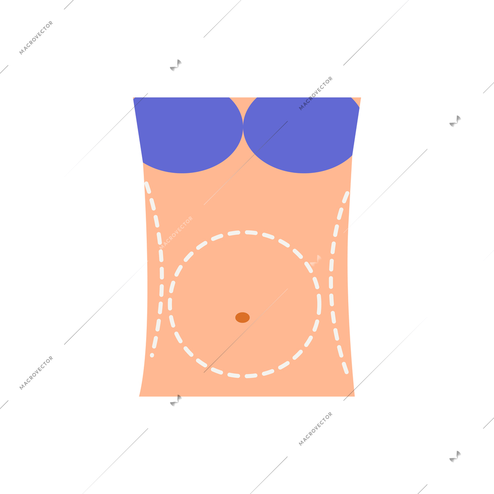 Plastic surgery flat composition with body contouring and rejuvenation for female patient vector illustration