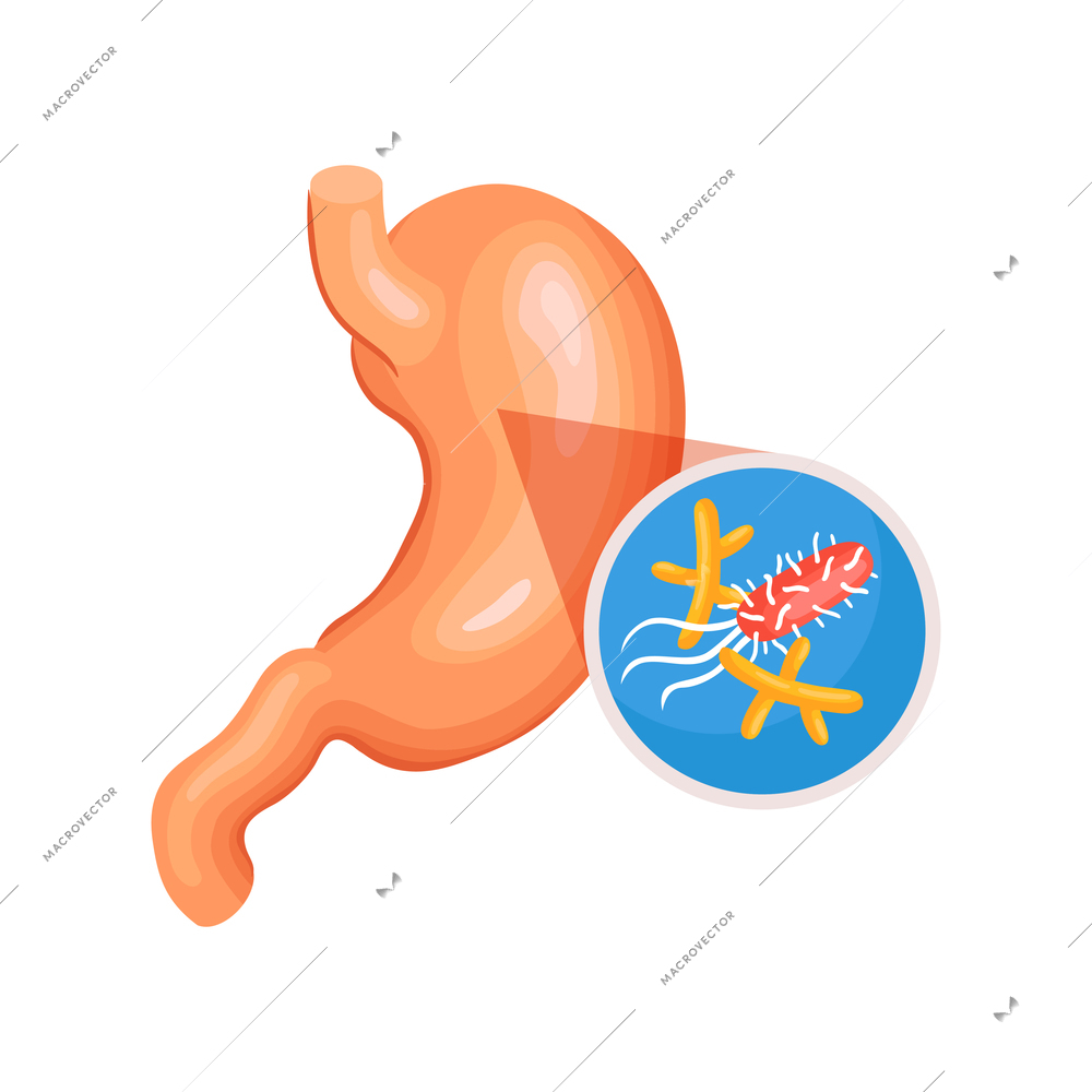 Isometric gastroenterology composition with image of stomach with helicobacteria vector illustration