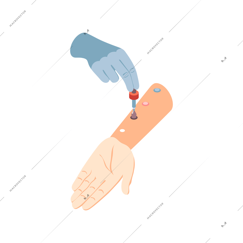 Isometric icon with process of laboratory skin prick allergy test vector illustration