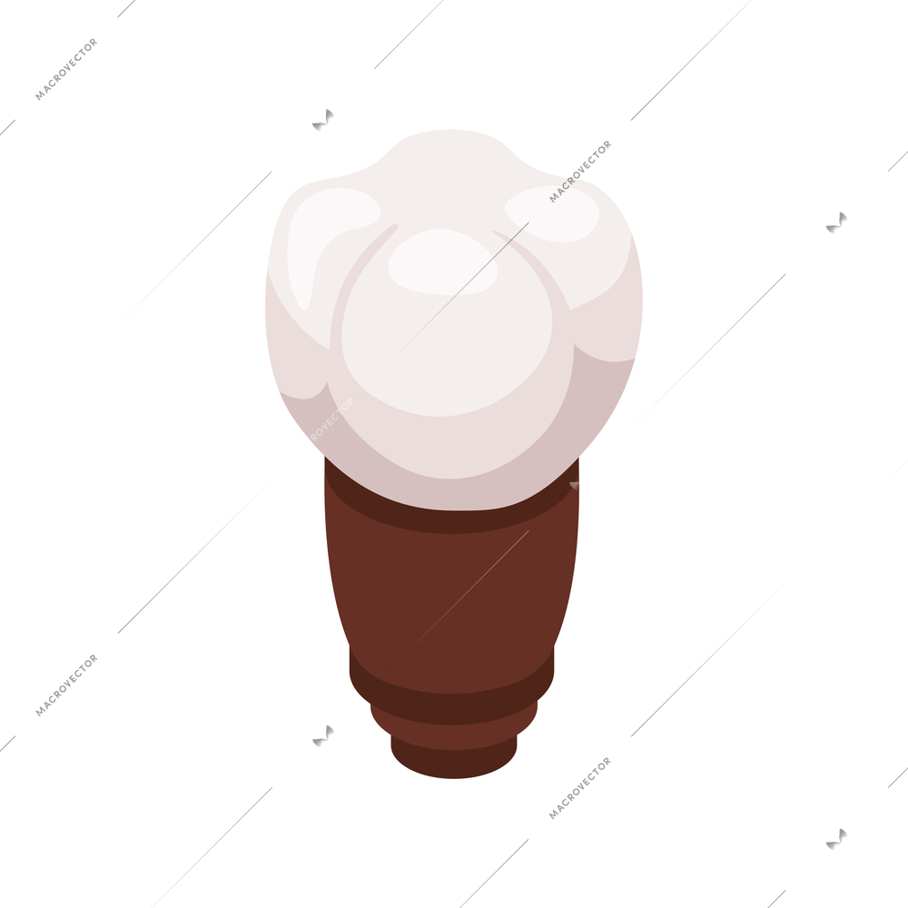 Isometric tooth implant metal dental post on white background 3d vector illustration