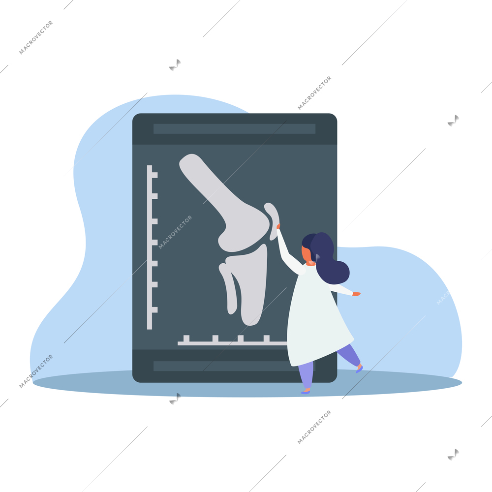 Orthopedics clinic flat composition with radiogram of bones in human knee with female doctor vector illustration