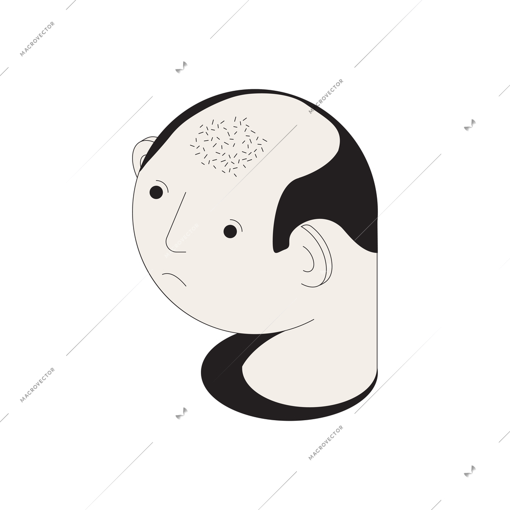 Hair problems isometric composition with isolated image of male head with low hair vector illustration