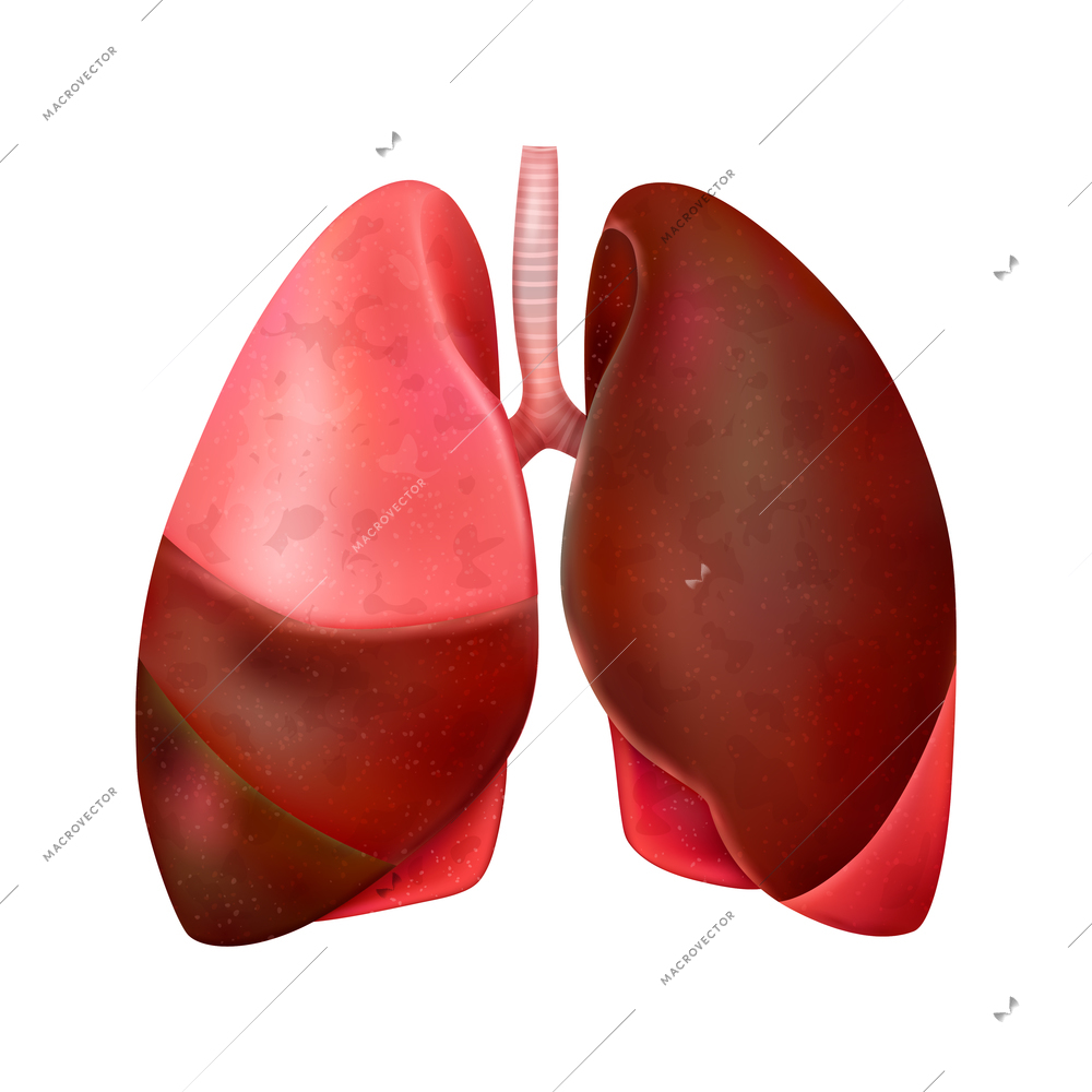 Realistic world pneumonia day composition with isolated image of damaged lungs vector illustration
