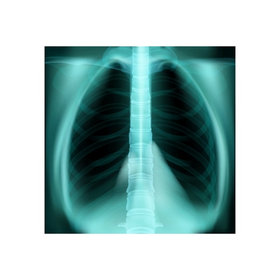 Realistic world pneumonia day composition with isolated image of xray shot of human lungs vector illustration